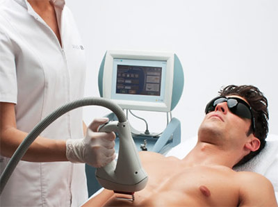laser-hair-removal-3