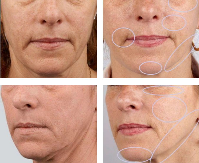 Beauty booster before after